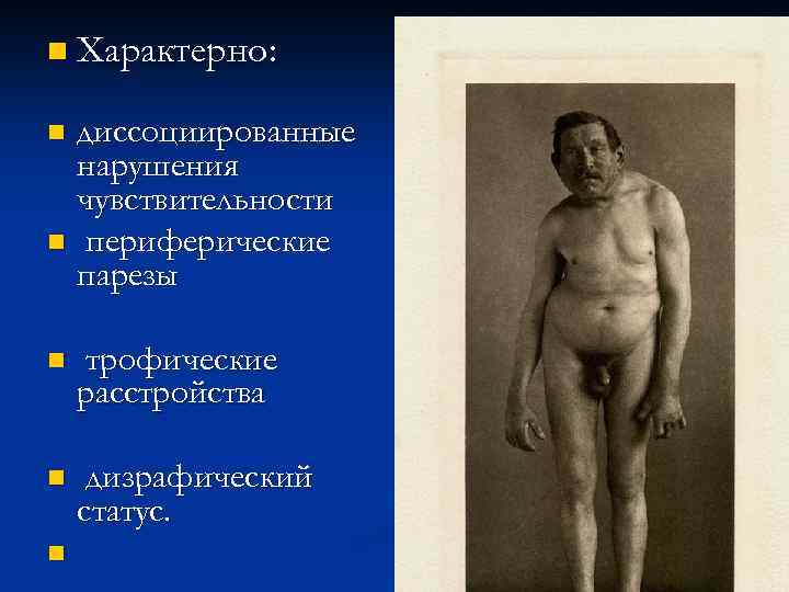 n Характерно: диссоциированные нарушения чувствительности n периферические парезы n n трофические расстройства n дизрафический