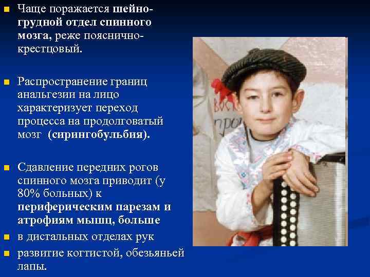 n Чаще поражается шейногрудной отдел спинного мозга, реже поясничнокрестцовый. n Распространение границ анальгезии на