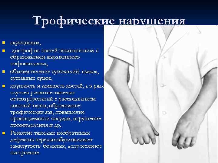 Трофические нарушения n n n акроцианоз, дистрофия костей позвоночника с образованием выраженного кифосколиоза, обызвествление