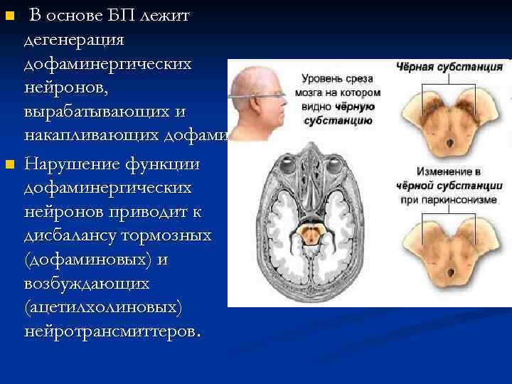 n n В основе БП лежит дегенерация дофаминергических нейронов, вырабатывающих и накапливающих дофамин. Нарушение