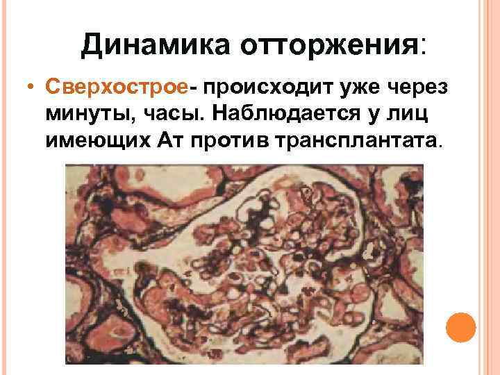 Динамика отторжения: • Сверхострое- происходит уже через минуты, часы. Наблюдается у лиц имеющих Ат