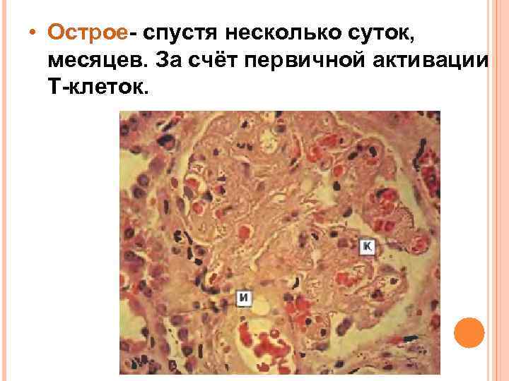  • Острое- спустя несколько суток, месяцев. За счёт первичной активации Т-клеток. 
