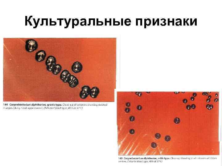 Культуральные признаки 