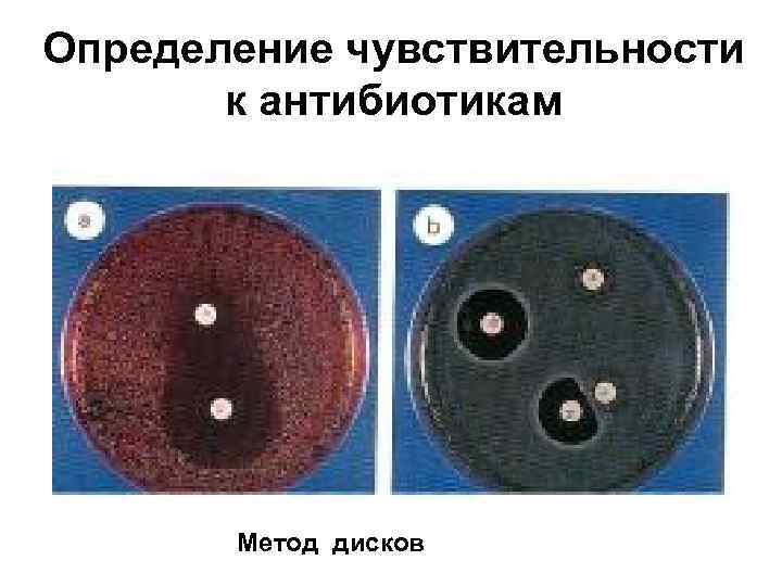 Определение чувствительности к антибиотикам Метод дисков 