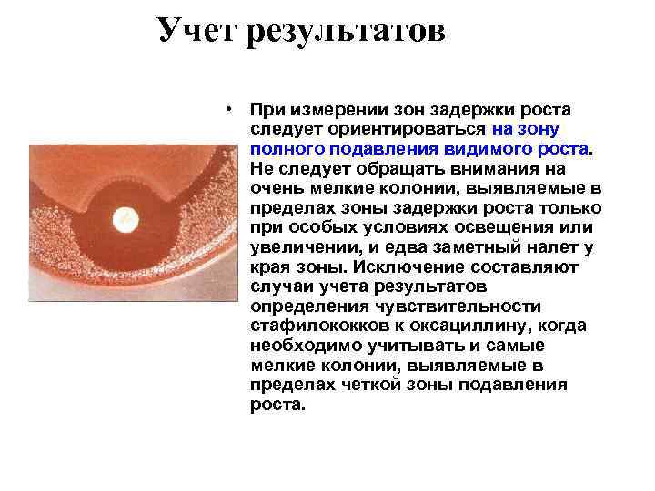 Учет результатов • При измерении зон задержки роста следует ориентироваться на зону полного подавления