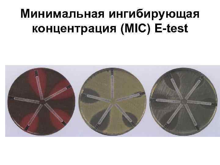 Минимальная ингибирующая концентрация (MIC) E-test 