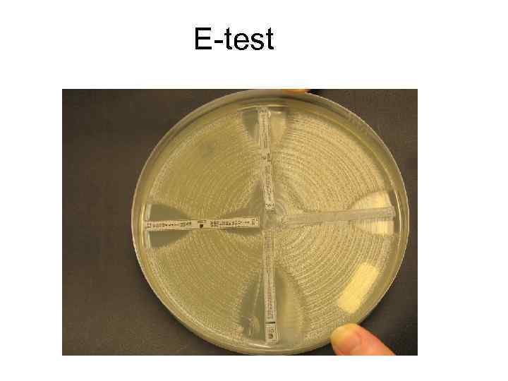 E-test 