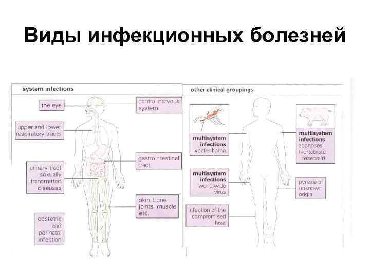 Виды инфекции схема