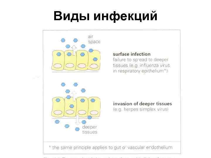 Виды инфекций 