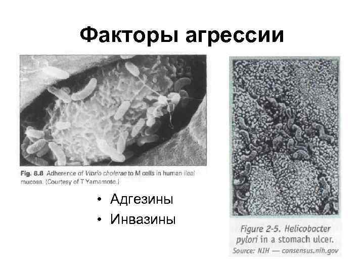 Факторы агрессии • Адгезины • Инвазины 