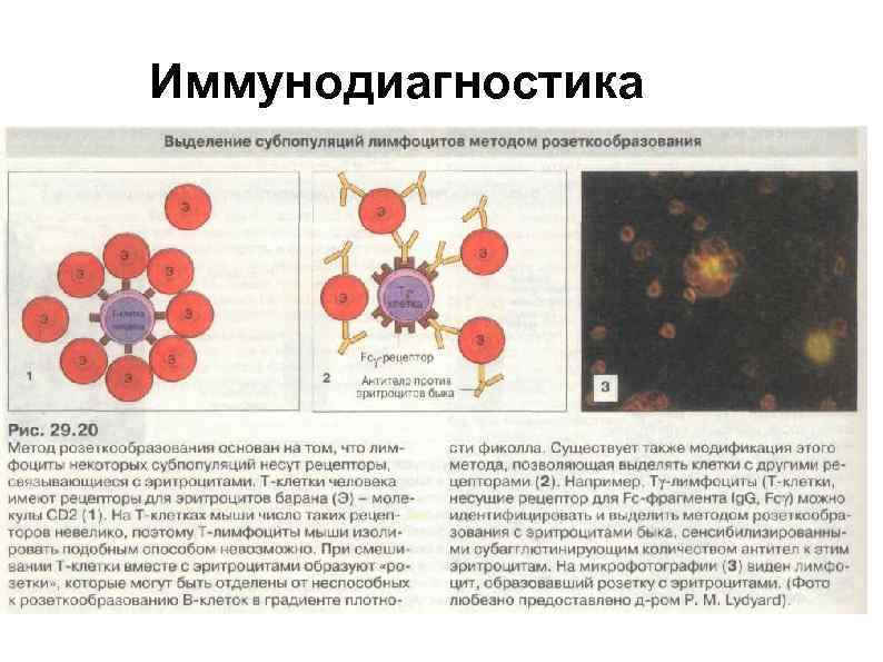 Первичный иммунодефицит картинки