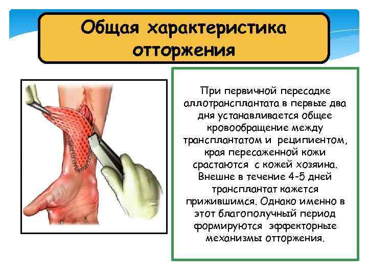 Общая характеристика отторжения При первичной пересадке аллотрансплантата в первые два дня устанавливается общее кровообращение