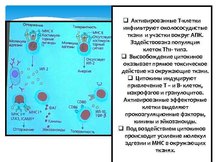 q Активированные Т-клетки инфильтруют околососудистые ткани и участки вокруг АПК. Задействована популяция клеток Th