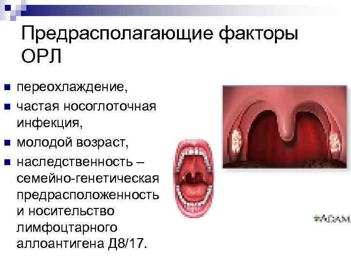 Предрасполагающие факторы ОРЛ n n переохлаждение, частая носоглоточная инфекция, молодой возраст, наследственность – семейно-генетическая