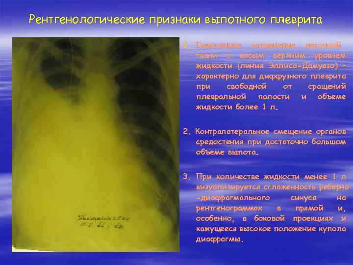 Легочные синусы свободны