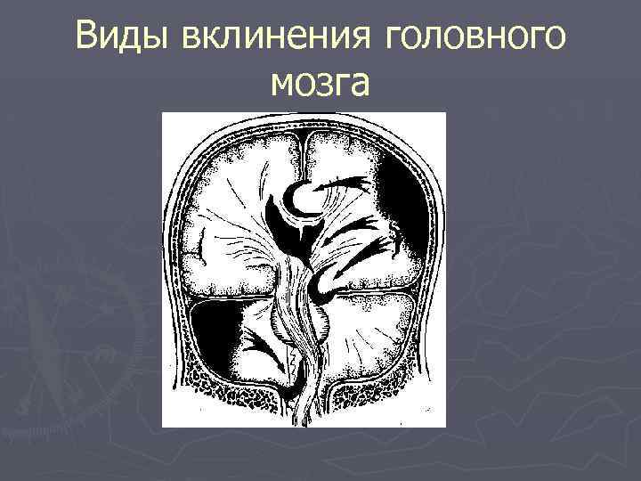 Центр обмена веществ в мозге