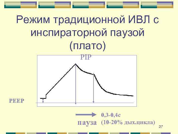 Режим традиционной ИВЛ с инспираторной паузой (плато) PIP PEEP пауза 0, 3 -0, 4