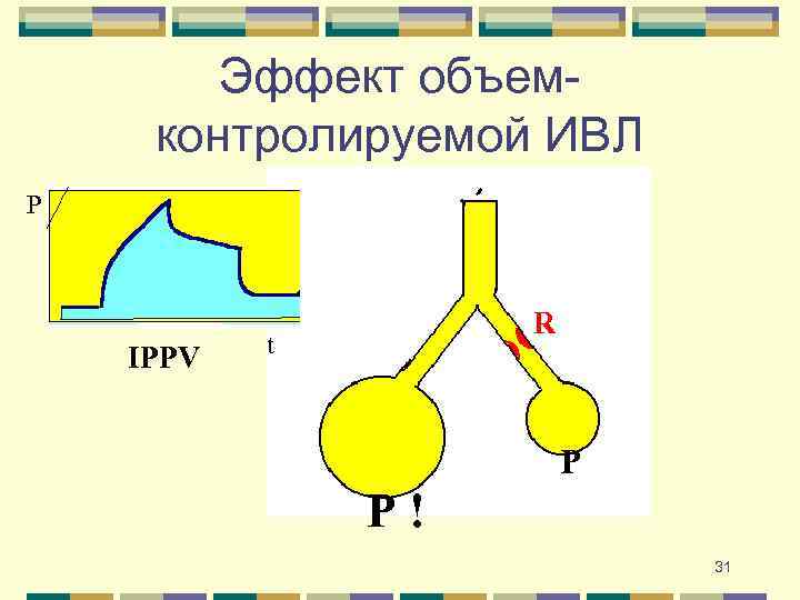 Эффект объемконтролируемой ИВЛ P IPPV R t P P! 31 