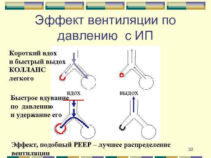 Эффект вентиляции по давлению с ИП Короткий вдох и быстрый выдох КОЛЛАПС легкого вдох