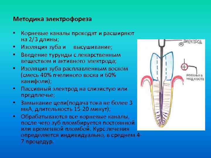 Физиотерапия при периодонтите презентация