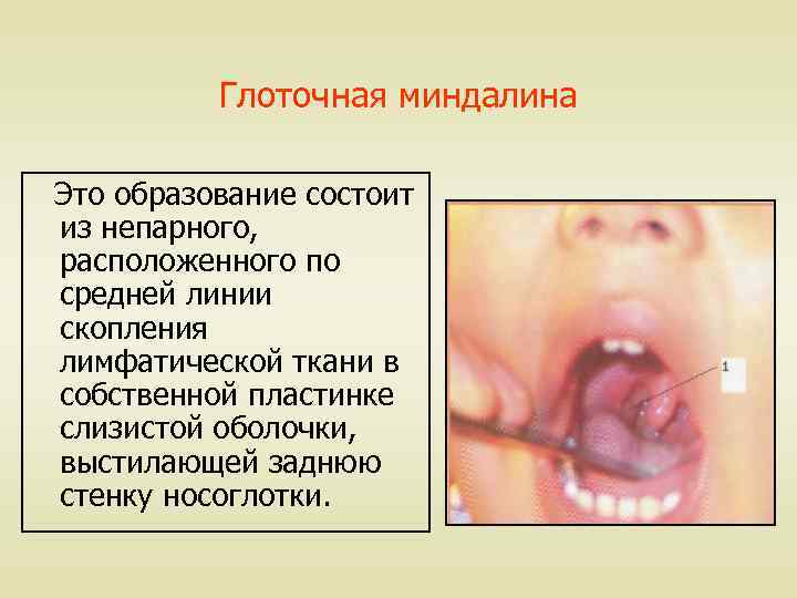 Глоточная миндалина Это образование состоит из непарного, расположенного по средней линии скопления лимфатической ткани