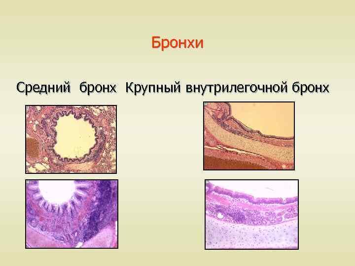 Бронхи Средний бронх Крупный внутрилегочной бронх 