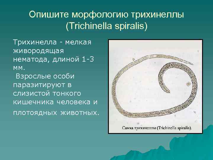 Круглым червям относят. Трихинеллы паразитические черви. Трихинелла (черви малого размера);. Трихинелла мелкая живородящая. Трихинелла относится к классу.