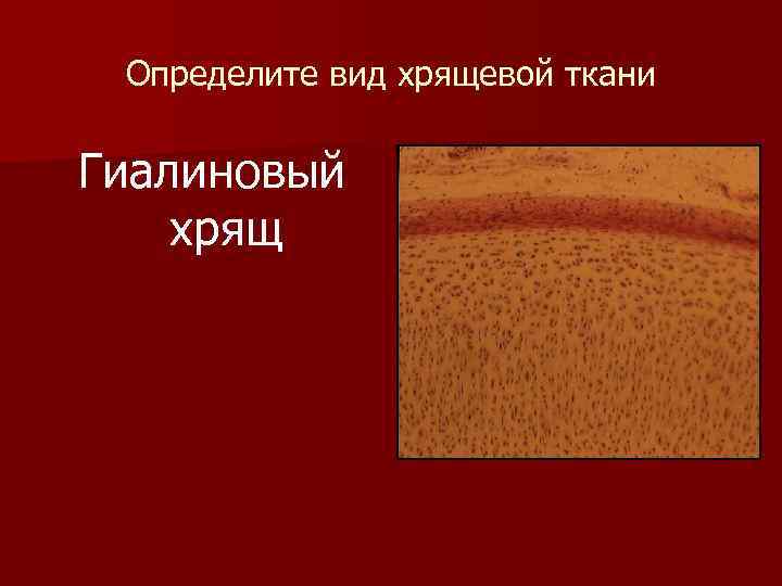  Определите вид хрящевой ткани Гиалиновый хрящ 