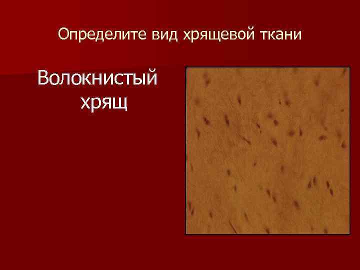  Определите вид хрящевой ткани Волокнистый хрящ 