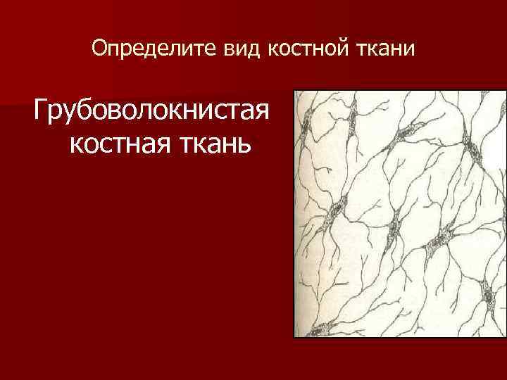  Определите вид костной ткани Грубоволокнистая костная ткань 