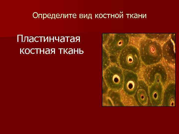  Определите вид костной ткани Пластинчатая костная ткань 