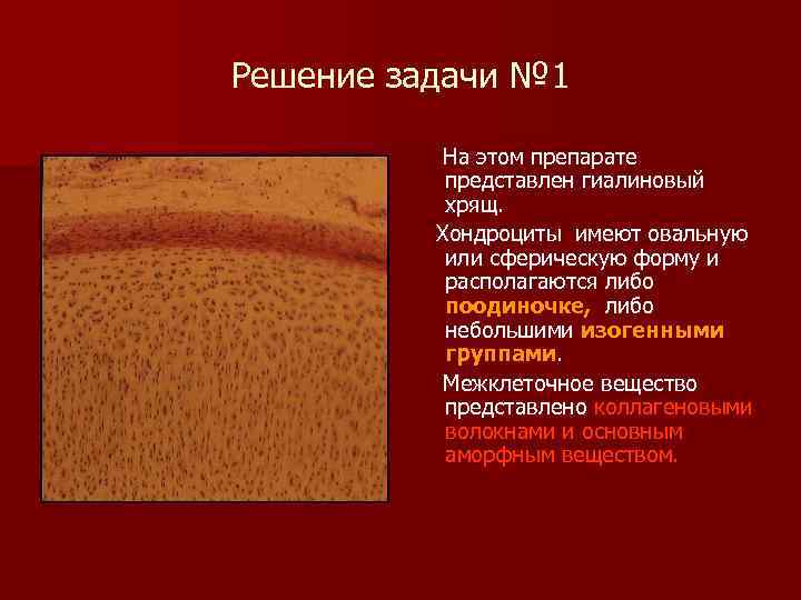 Решение задачи № 1 На этом препарате представлен гиалиновый хрящ. Хондроциты имеют овальную или