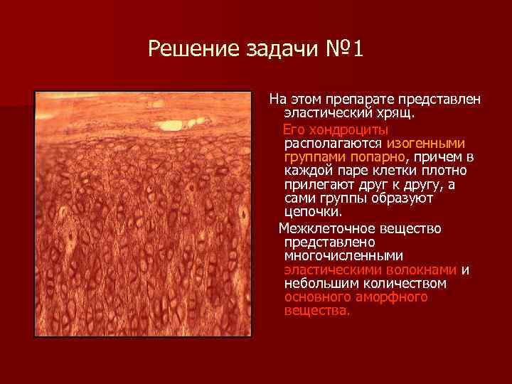 Решение задачи № 1 На этом препарате представлен эластический хрящ. Его хондроциты располагаются изогенными