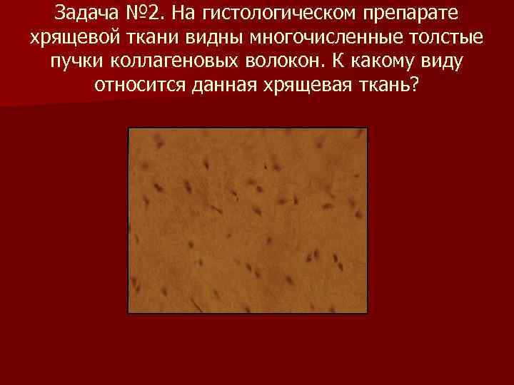  Задача № 2. На гистологическом препарате хрящевой ткани видны многочисленные толстые пучки коллагеновых