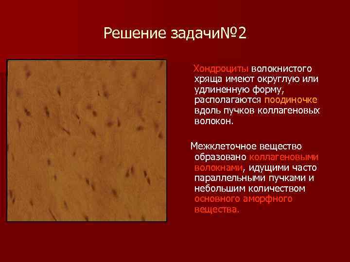 Решение задачи№ 2 Хондроциты волокнистого хряща имеют округлую или удлиненную форму, располагаются поодиночке вдоль