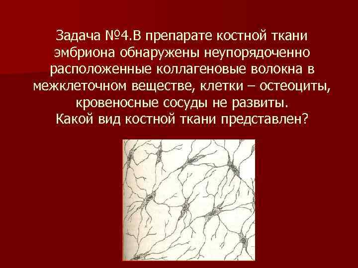  Задача № 4. В препарате костной ткани эмбриона обнаружены неупорядоченно расположенные коллагеновые волокна