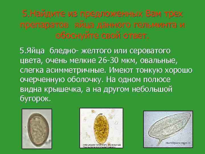 5. Найдите из предложенных Вам трех препаратов яйца данного гельминта и обоснуйте свой ответ.