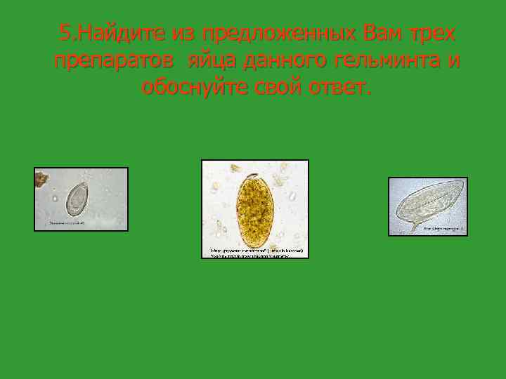 5. Найдите из предложенных Вам трех препаратов яйца данного гельминта и обоснуйте свой ответ.