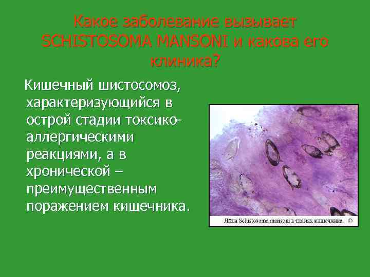 Какое заболевание вызывает SCHISTOSOMA MANSONI и какова его клиника? Кишечный шистосомоз, характеризующийся в острой