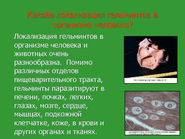 Какова локализация гельминтов в организме человека? Локализация гельминтов в организме человека и животных очень