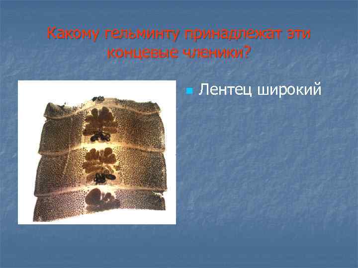 Какому гельминту принадлежат эти концевые членики? n Лентец широкий 