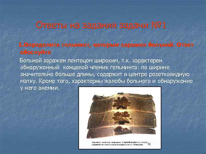 Ответы на задания задачи № 1 1. Определите гельминт, которым заражен больной. Ответ обоснуйте