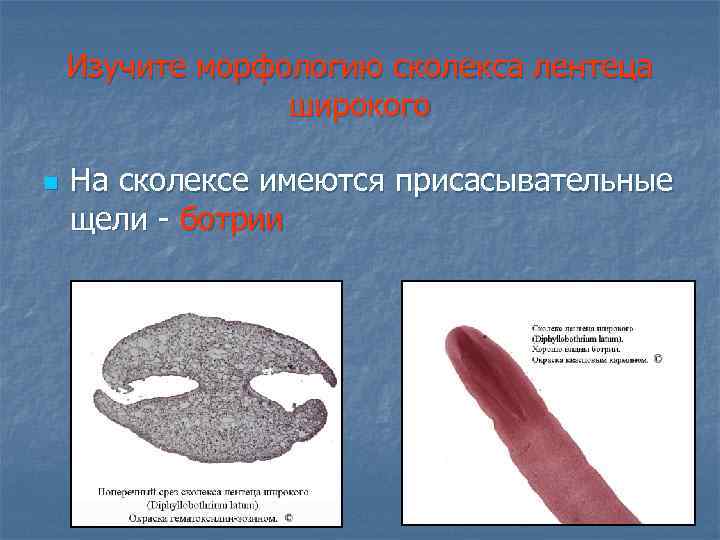 Изучите морфологию сколекса лентеца широкого n На сколексе имеются присасывательные щели - ботрии 