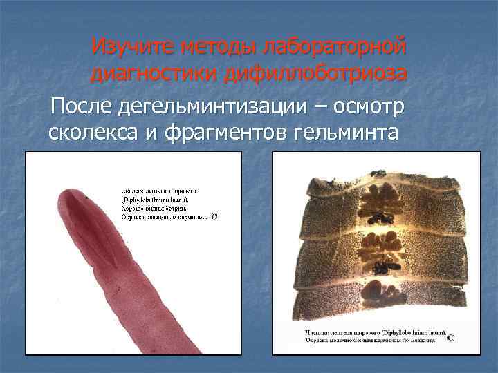 Изучите методы лабораторной диагностики дифиллоботриоза После дегельминтизации – осмотр сколекса и фрагментов гельминта 