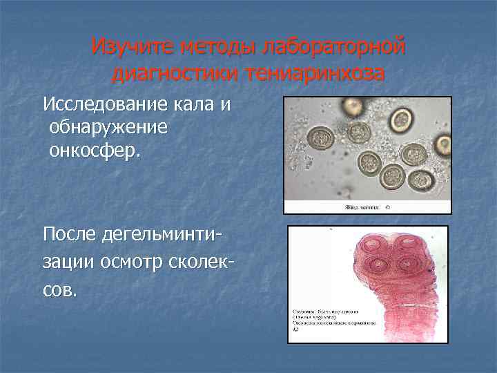 Изучите методы лабораторной диагностики тениаринхоза Исследование кала и обнаружение онкосфер. После дегельминтизации осмотр сколексов.