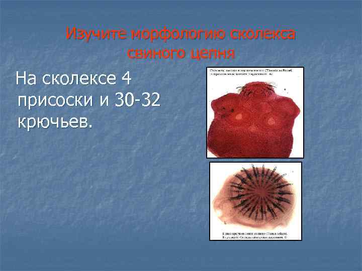 Изучите морфологию сколекса свиного цепня На сколексе 4 присоски и 30 -32 крючьев. 
