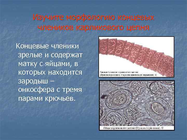 Изучите морфологию концевых члеников карликового цепня Концевые членики зрелые и содержат матку с яйцами,