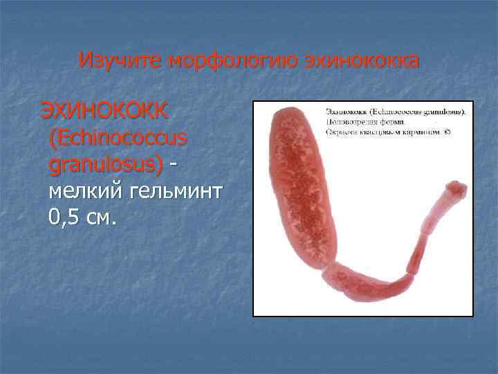 Изучите морфологию эхинококка ЭХИНОКОКК (Echinococcus granulosus) мелкий гельминт 0, 5 см. 