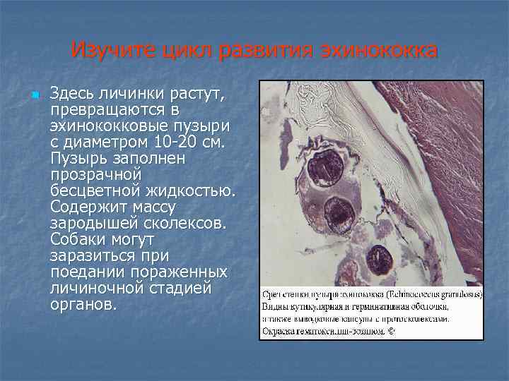 Изучите цикл развития эхинококка n Здесь личинки растут, превращаются в эхинококковые пузыри с диаметром