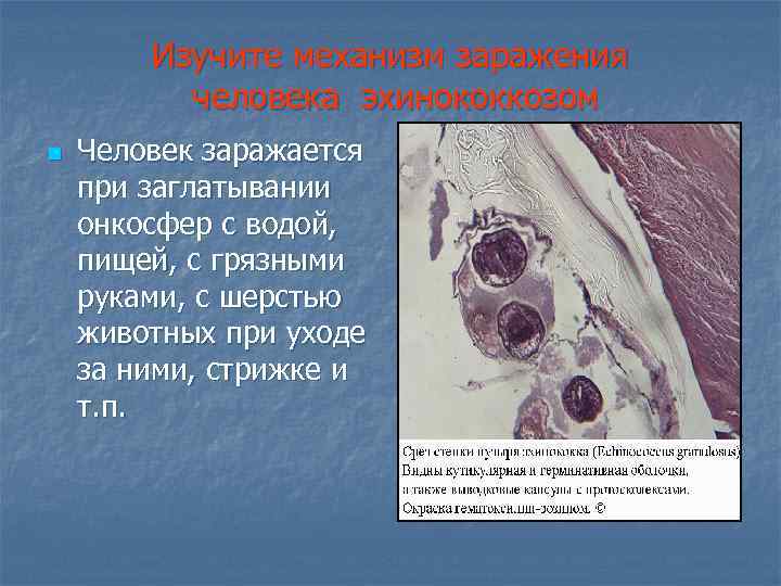 Изучите механизм заражения человека эхинококкозом n Человек заражается при заглатывании онкосфер с водой, пищей,